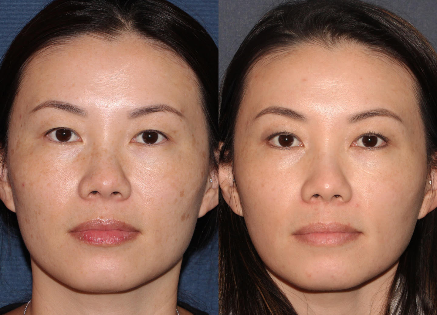 美妆已死，医美当道？