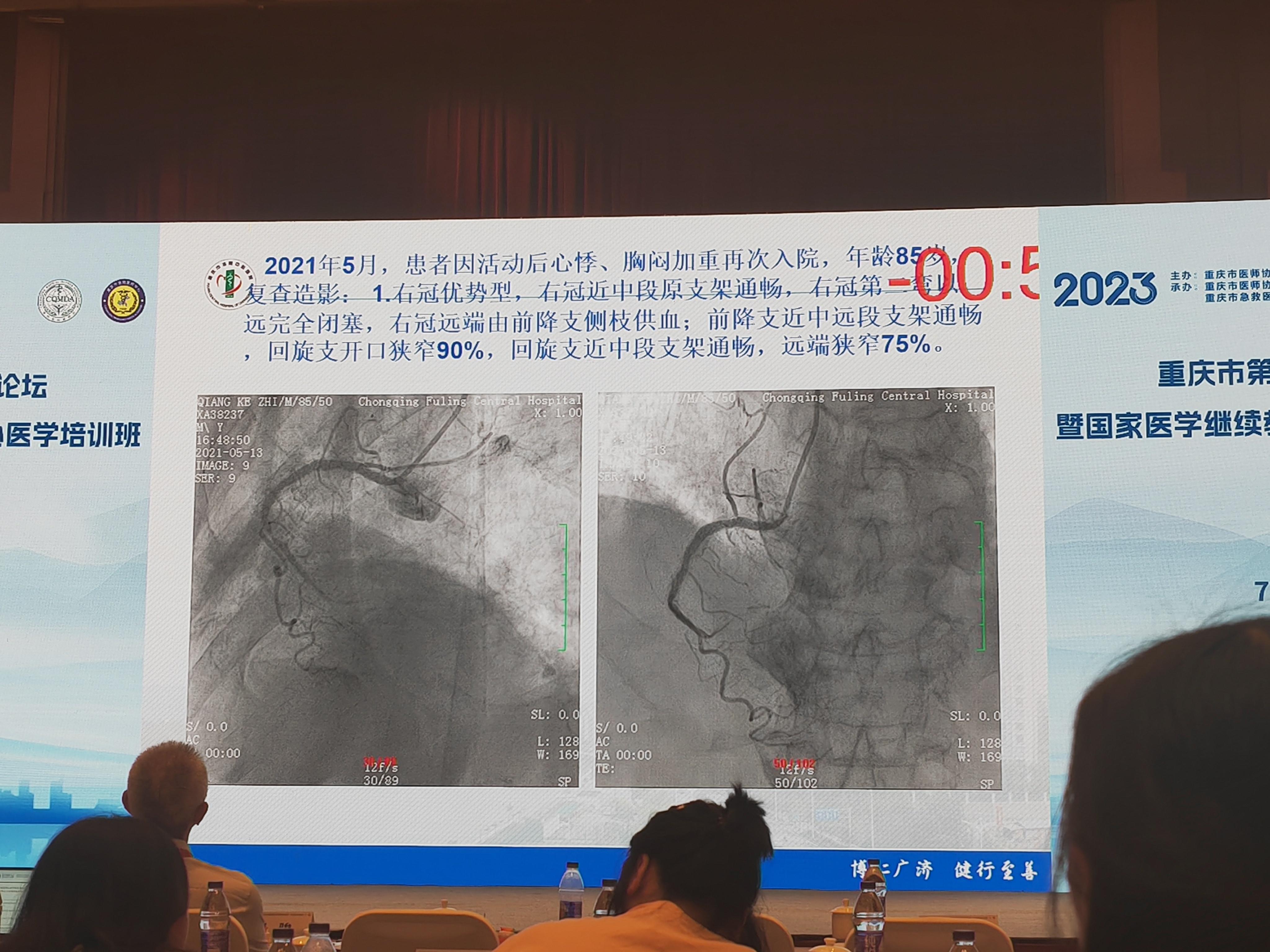 心脉医疗获得实用新型专利授权：“血管支架以及支架系统”