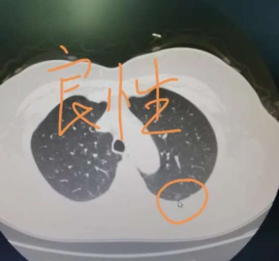 几百元体检难查癌症？爱康董事长张黎刚：公众对体检与看病没明确边界