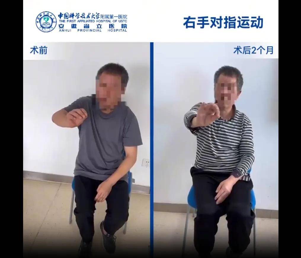 帕金森病“早检难”将改写 确诊时间提前7年