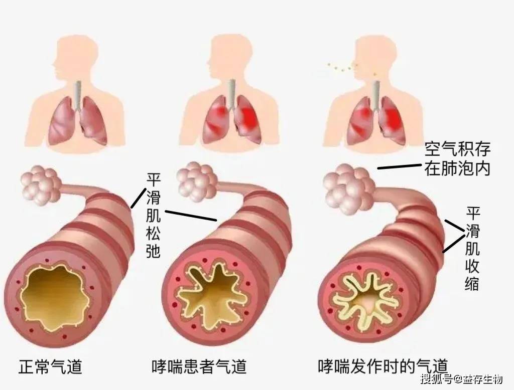脱敏治疗市场空间亟待释放，龙头企业我武生物优势显著