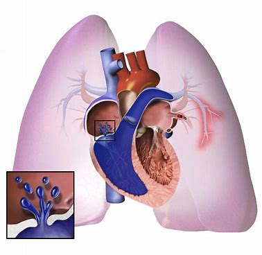 我武生物：取得屋尘螨膜剂I期临床试验总结报告