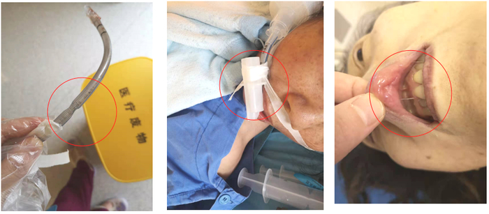 宝光股份获得实用新型专利授权:“一种真空灭弧室防过拉伸型老炼检测工装”