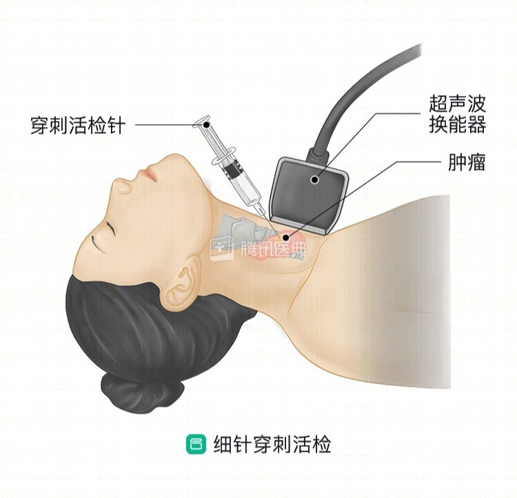维力医疗获得实用新型专利授权：“一种用于活检针的自动锁针结构”