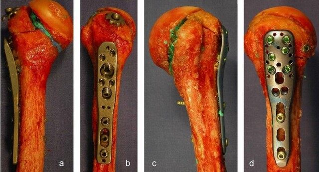 中国汽研获得发明专利授权：“一种仿人肋骨的胸部生物力学性能模拟模块及测量方法”